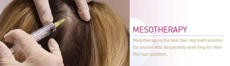  Mesotherapy for hair growth in malleswaram