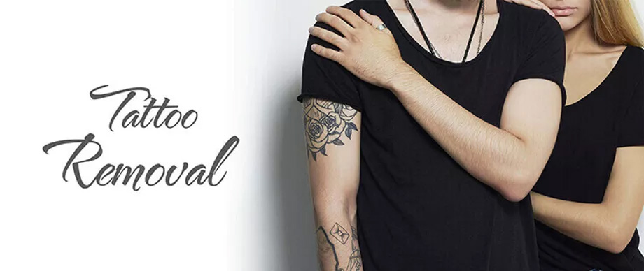 Tattoo Removal Center in Bangalore